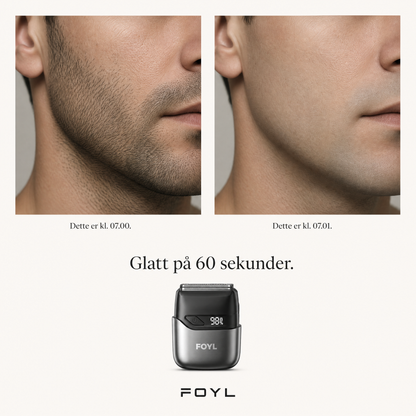 FOYL ONE – Slutt på røde prikker etter barbering